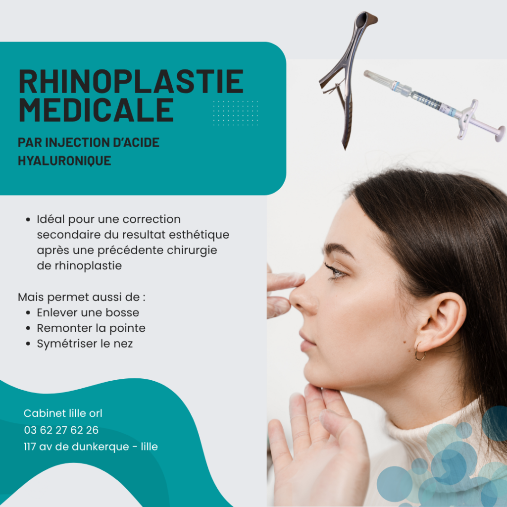 Rhinoplastie médicale à Lille par injection d'acide hyaluronique